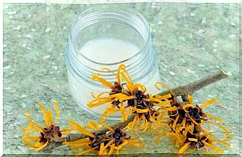 Witch Hazel to soothe the itch