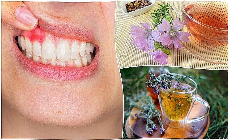 5 Natural Remedies to Control Gingivitis Symptoms