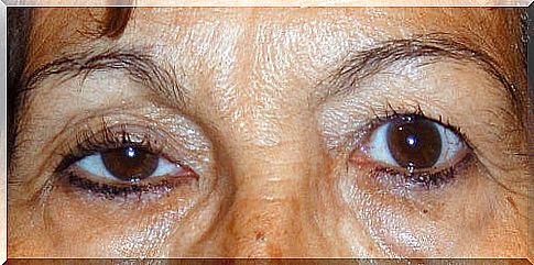 woman who has eye problems