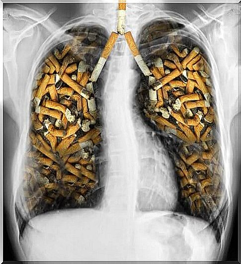 Cigarette damage to lungs