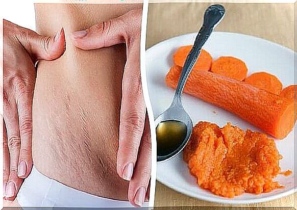 Carrot helps to reduce stretch marks on the skin