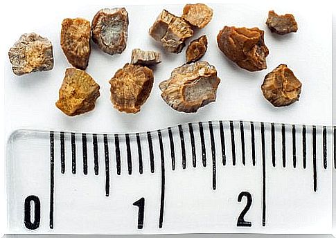 Kidney Stones: 6 Homemade Recipes to Fight Them