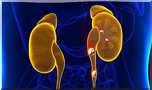 kidney health