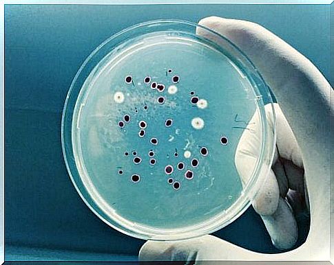 Analysis of microorganisms in the laboratory